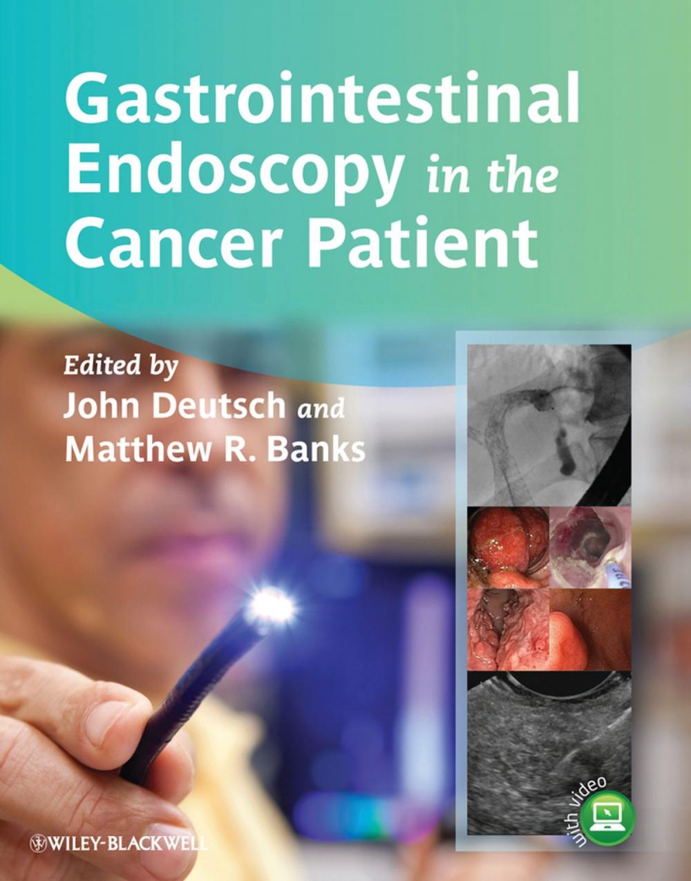 Big bigCover of Gastrointestinal Endoscopy in the Cancer Patient