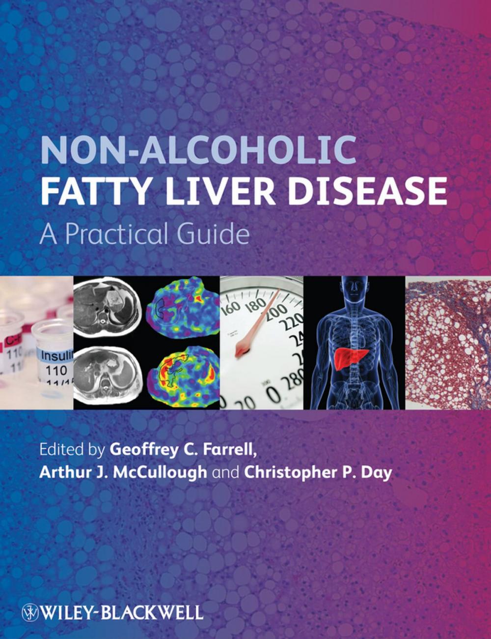 Big bigCover of Non-Alcoholic Fatty Liver Disease