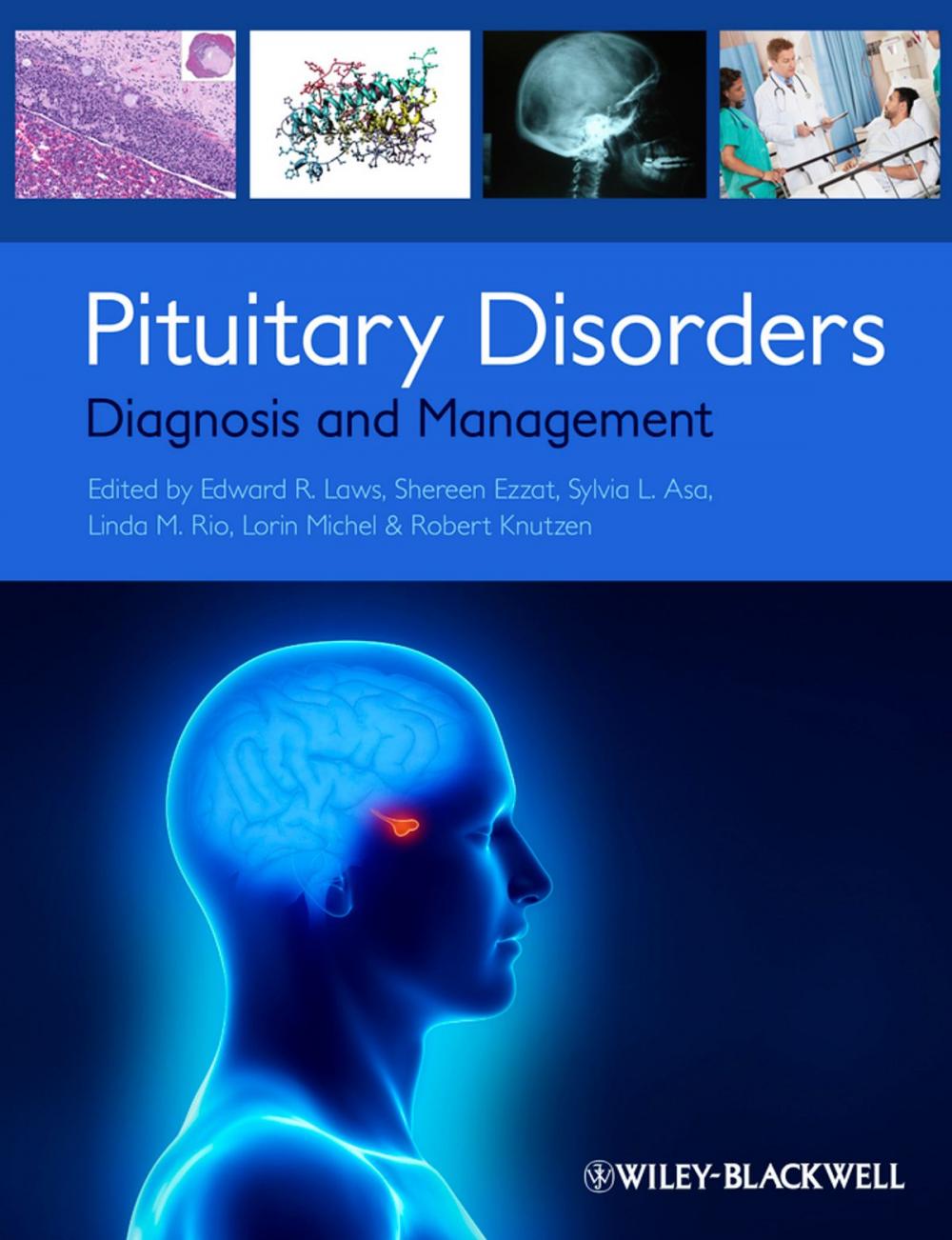 Big bigCover of Pituitary Disorders