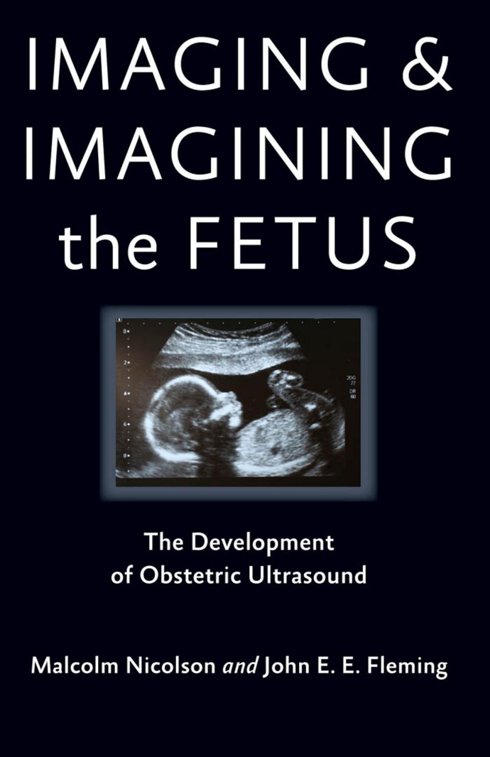 Big bigCover of Imaging and Imagining the Fetus