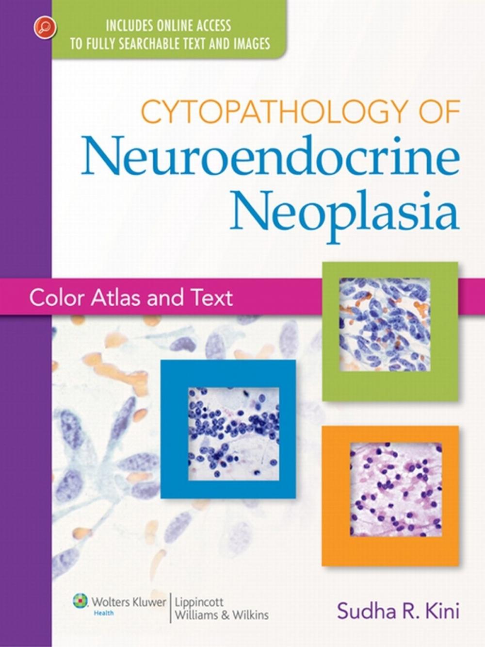 Big bigCover of Cytopathology of Neuroendocrine Neoplasia