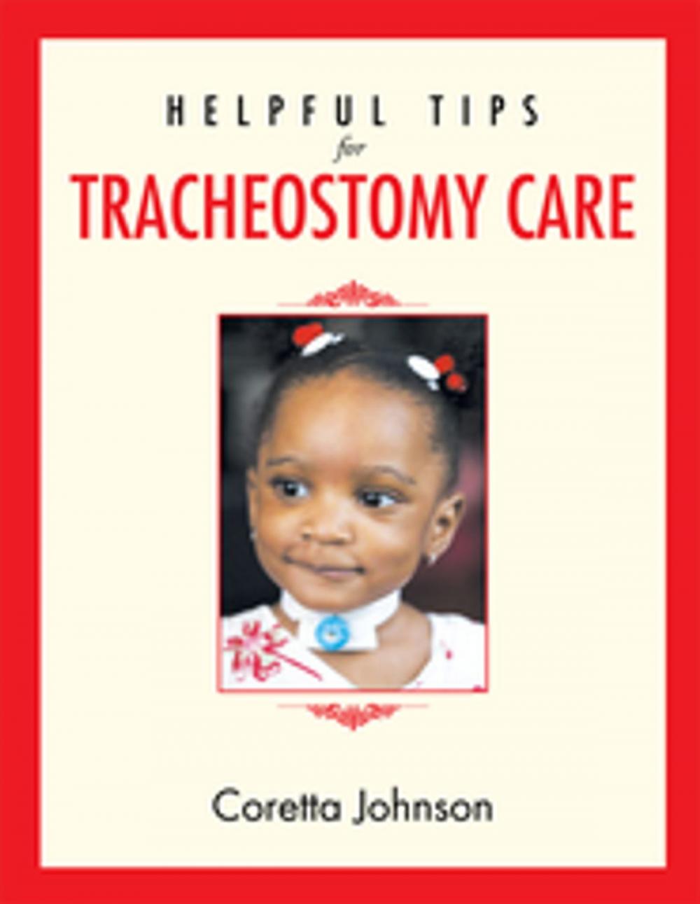 Big bigCover of Helpful Tips for Tracheostomy Care