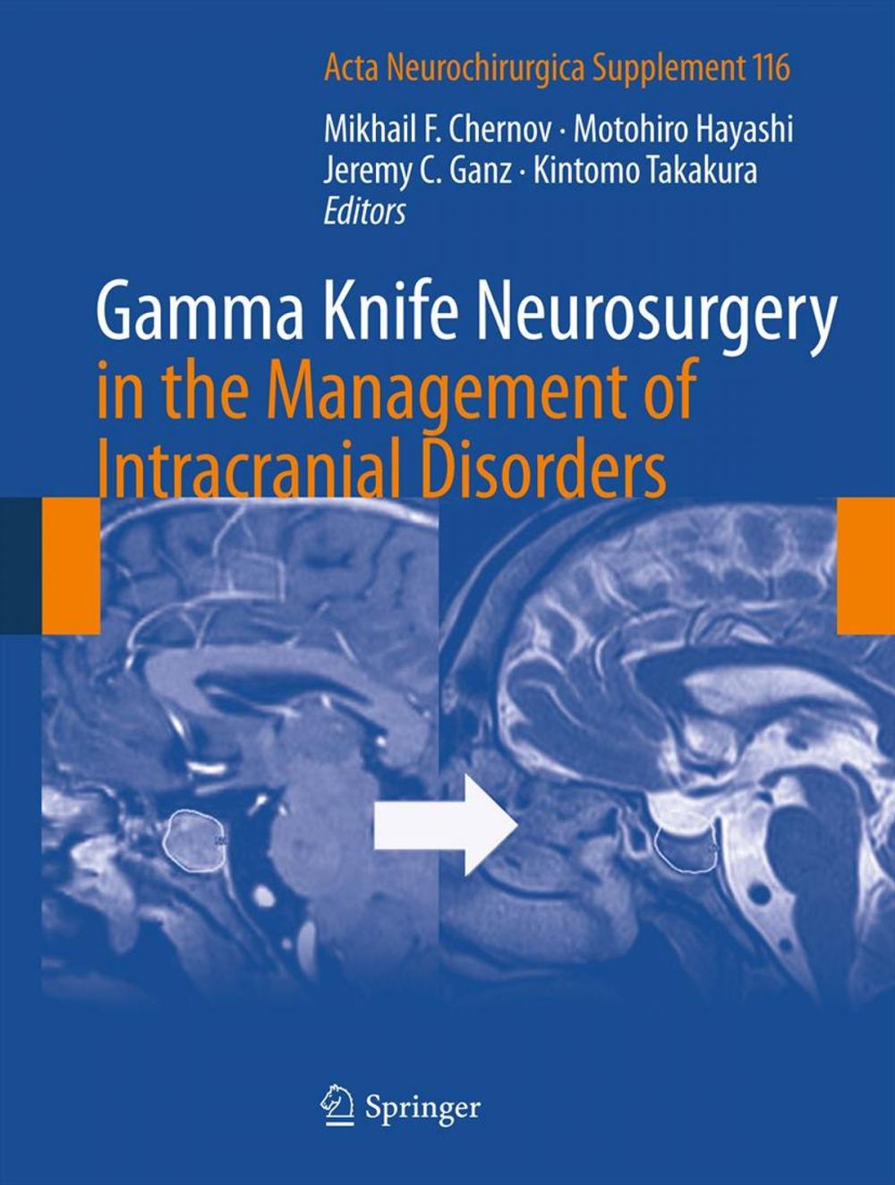 Big bigCover of Gamma Knife Neurosurgery in the Management of Intracranial Disorders