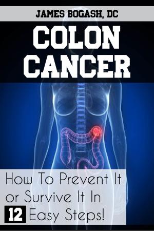 Cover of the book Colon Cancer: How to Prevent it or Survive it in 12 Easy Steps by James Bogash, DC
