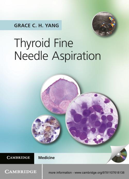 Cover of the book Thyroid Fine Needle Aspiration by Grace C. H. Yang, Cambridge University Press