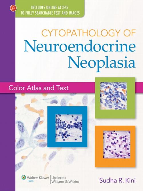 Cover of the book Cytopathology of Neuroendocrine Neoplasia by Sudha R. Kini, Wolters Kluwer Health