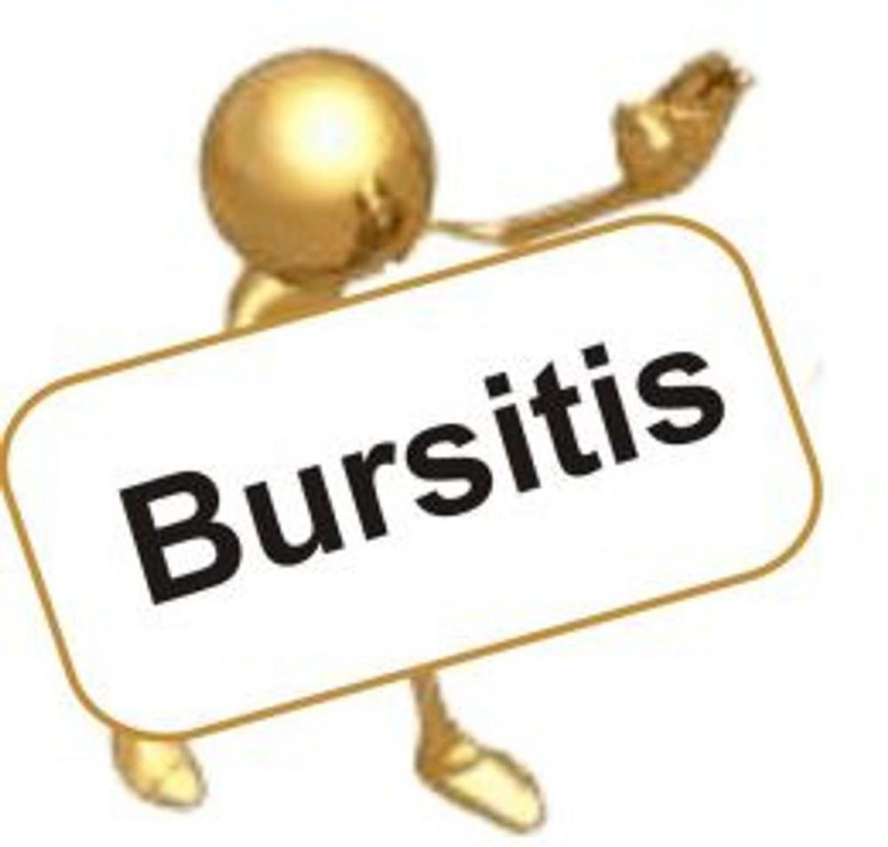 Big bigCover of Bursitis: Causes, Symptoms and Treatments