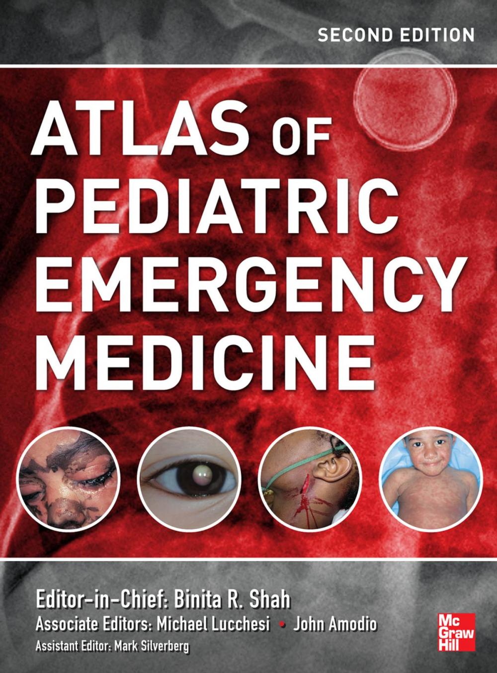 Big bigCover of Atlas of Pediatric Emergency Medicine, Second Edition