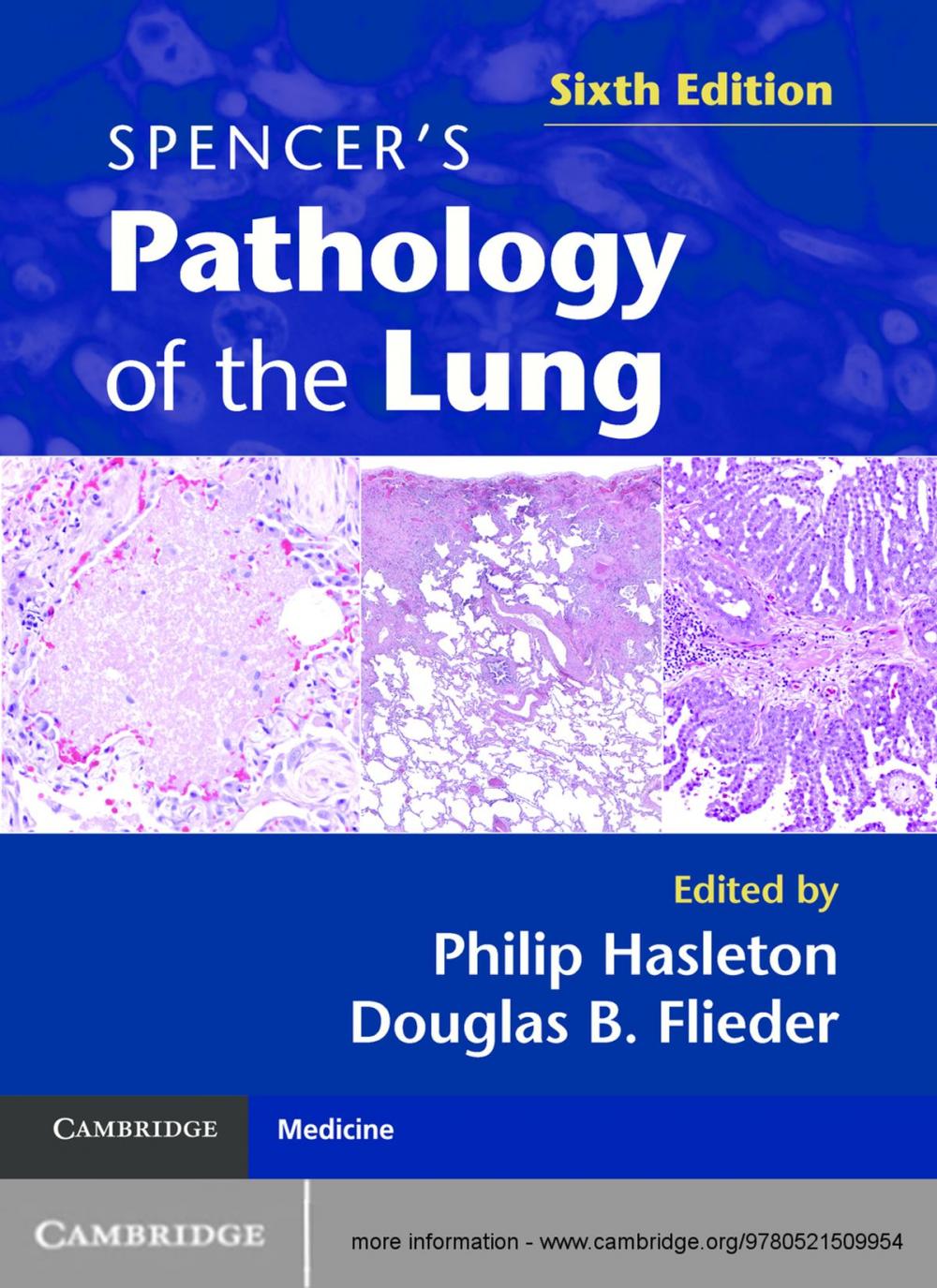 Big bigCover of Spencer's Pathology of the Lung