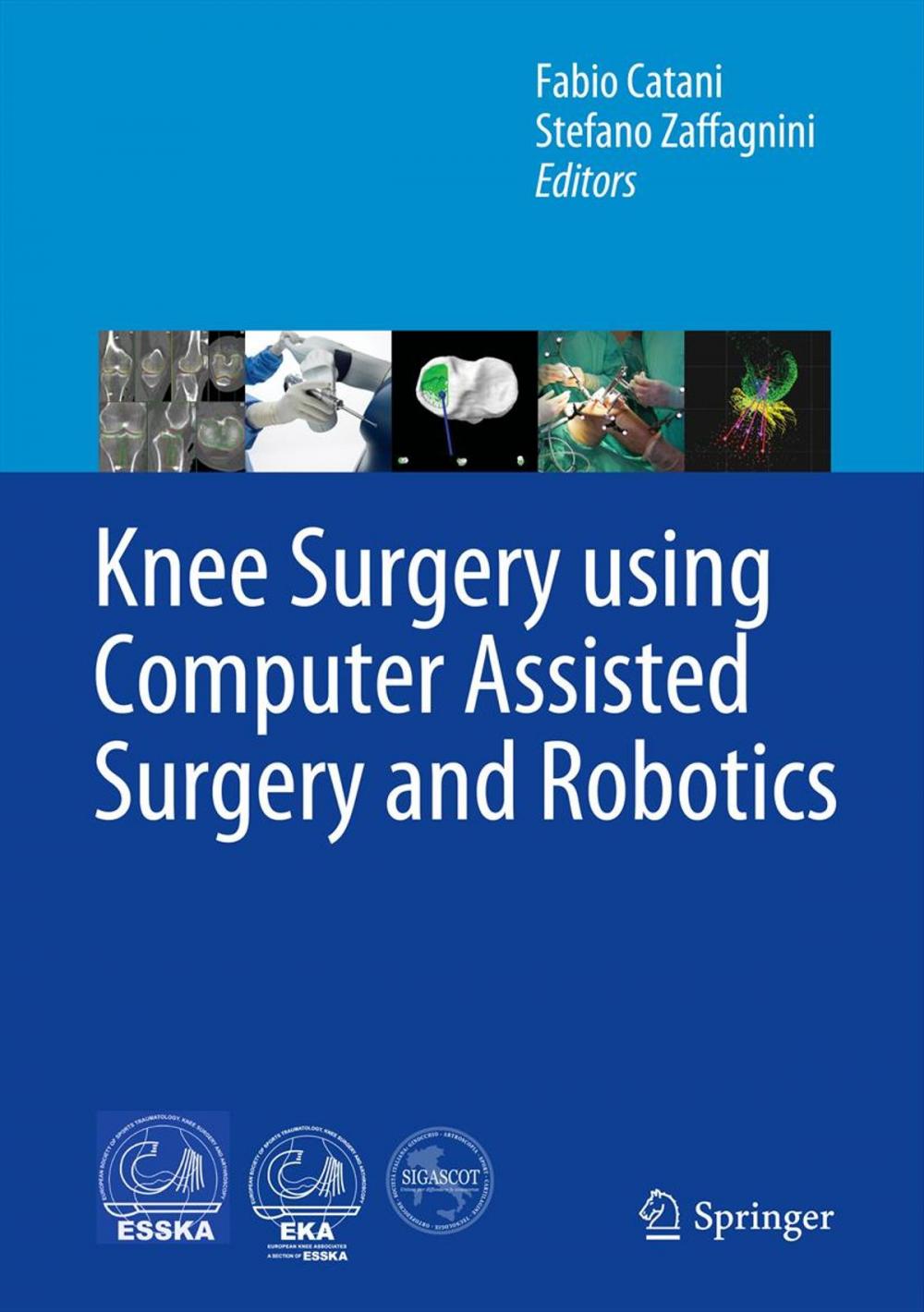 Big bigCover of Knee Surgery using Computer Assisted Surgery and Robotics