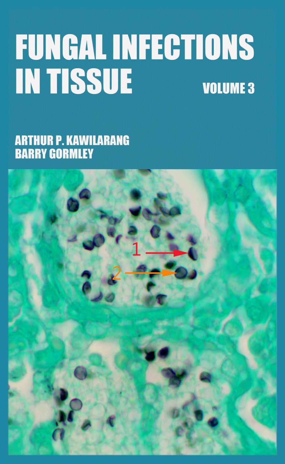 Big bigCover of Fungal Infections in Tissue Volume 3