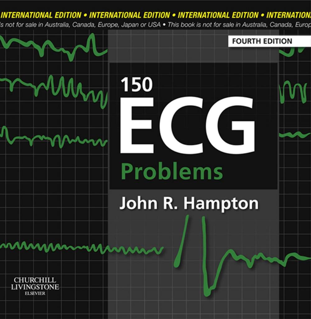 Big bigCover of 150 ECG Problems E-Book