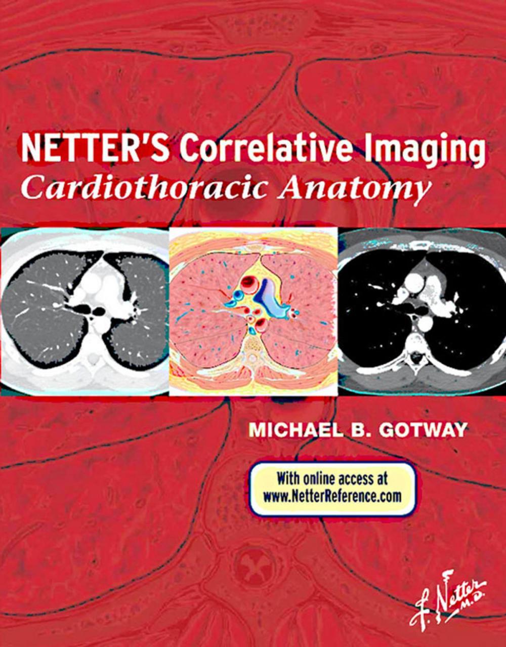 Big bigCover of Netter’s Correlative Imaging: Cardiothoracic Anatomy E-Book