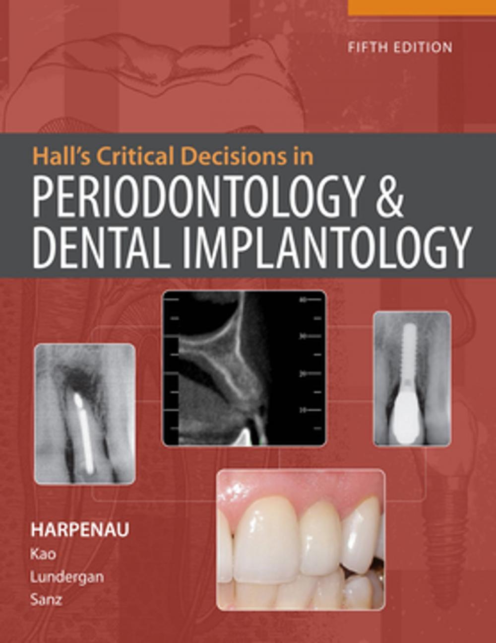 Big bigCover of Hall's Critical Decisions in Periodontology & Dental Implantology, 5e