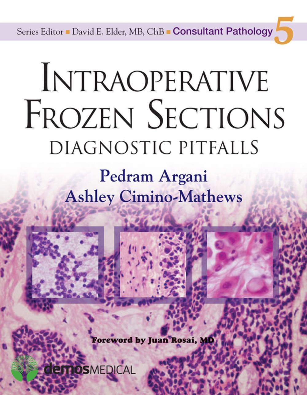 Big bigCover of Intraoperative Frozen Sections