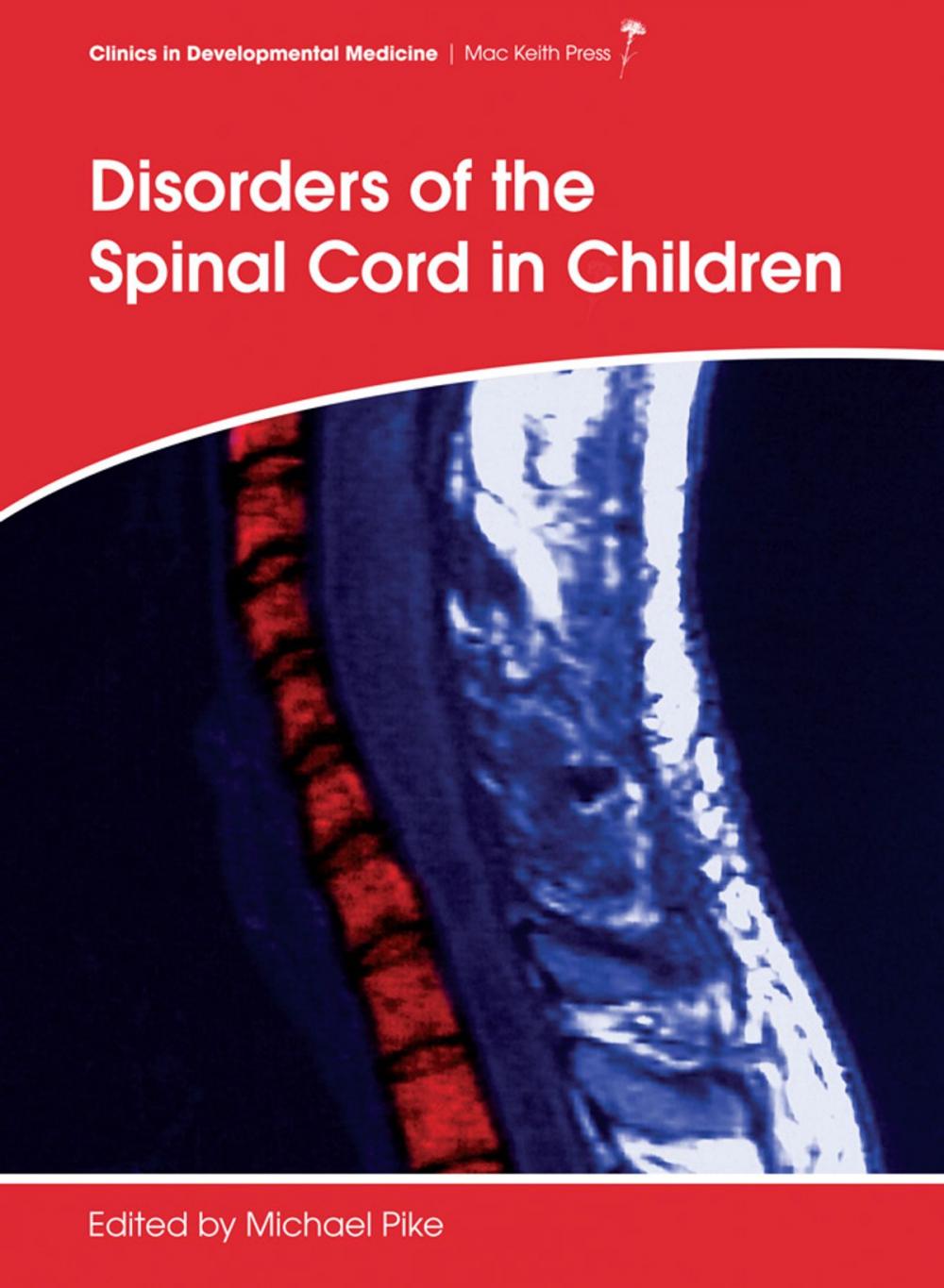 Big bigCover of Disorders of the Spinal Cord in Children