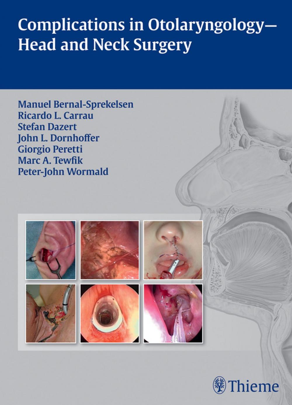 Big bigCover of Complications in Otolaryngology-Head and Neck Surgery