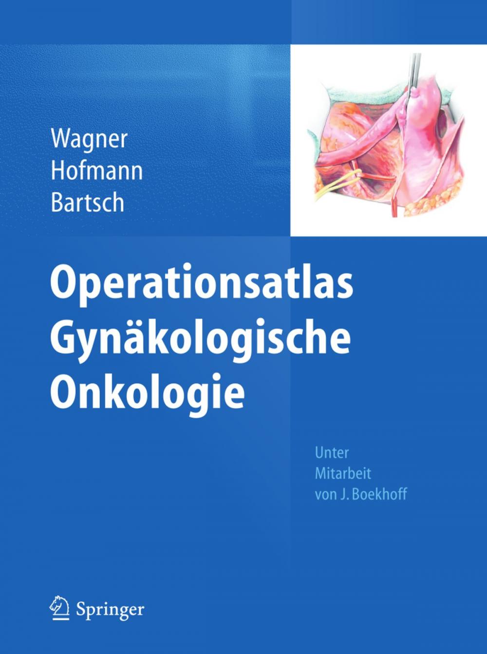 Big bigCover of Operationsatlas Gynäkologische Onkologie