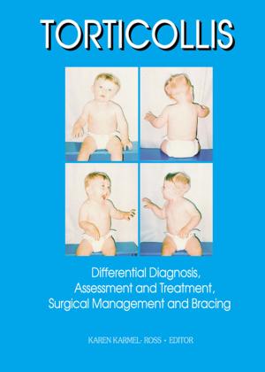 Cover of the book Torticollis by Jonathan Cowie