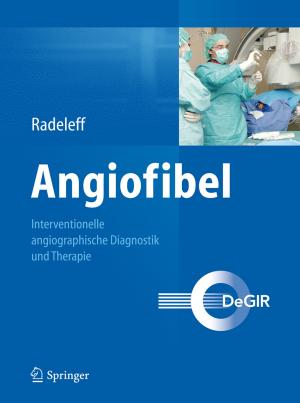 Cover of the book Angiofibel by Markus Klimmer, Jürgen Selonke