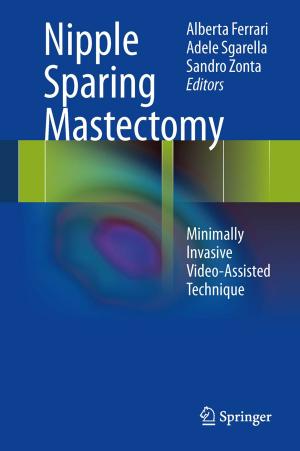 bigCover of the book Nipple Sparing Mastectomy by 