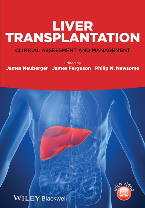 Cover of the book Liver Transplantation by , Wiley