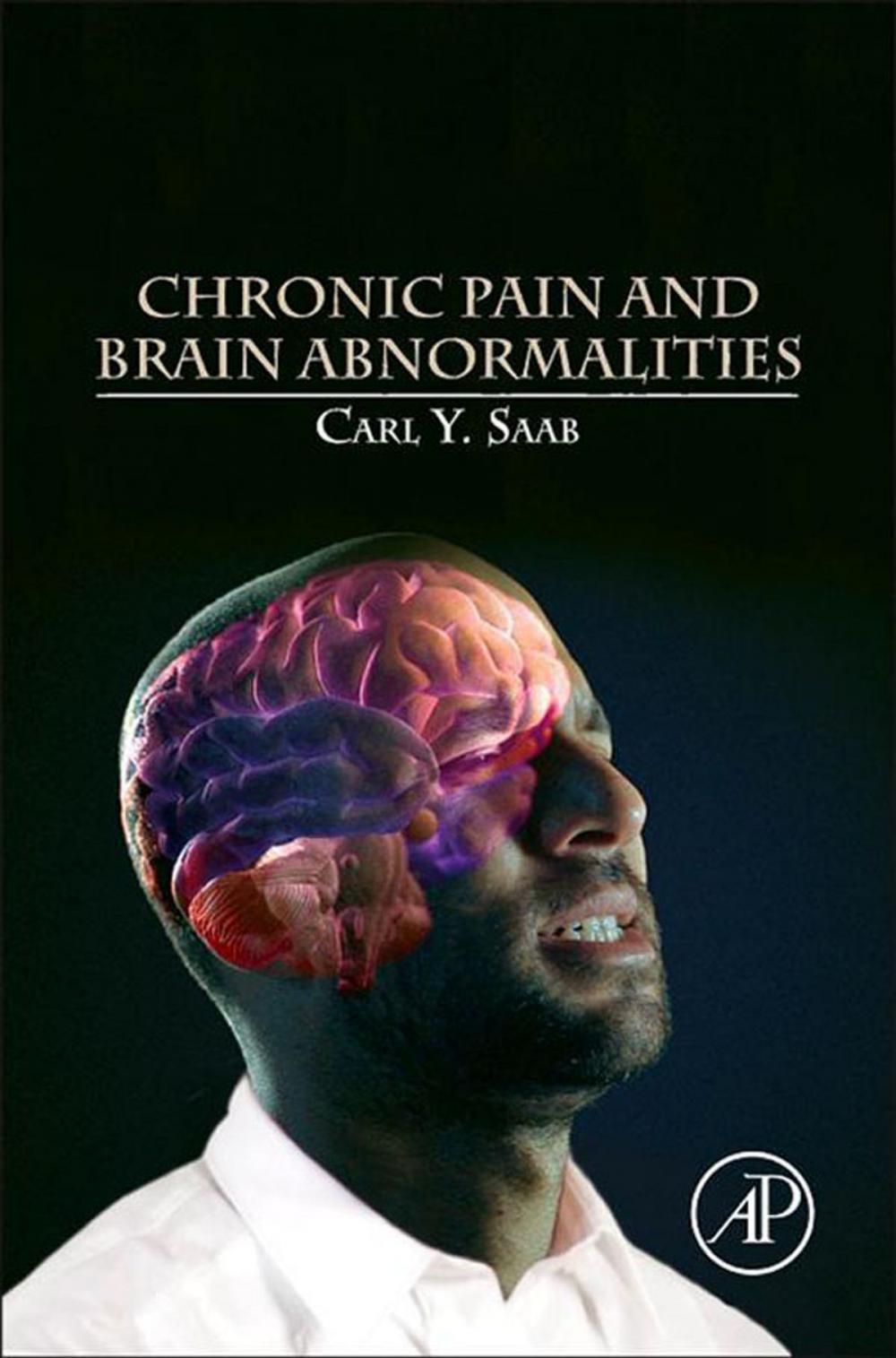 Big bigCover of Chronic Pain and Brain Abnormalities