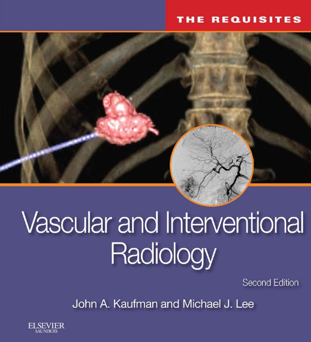 Big bigCover of Vascular and Interventional Radiology: The Requisites E-Book