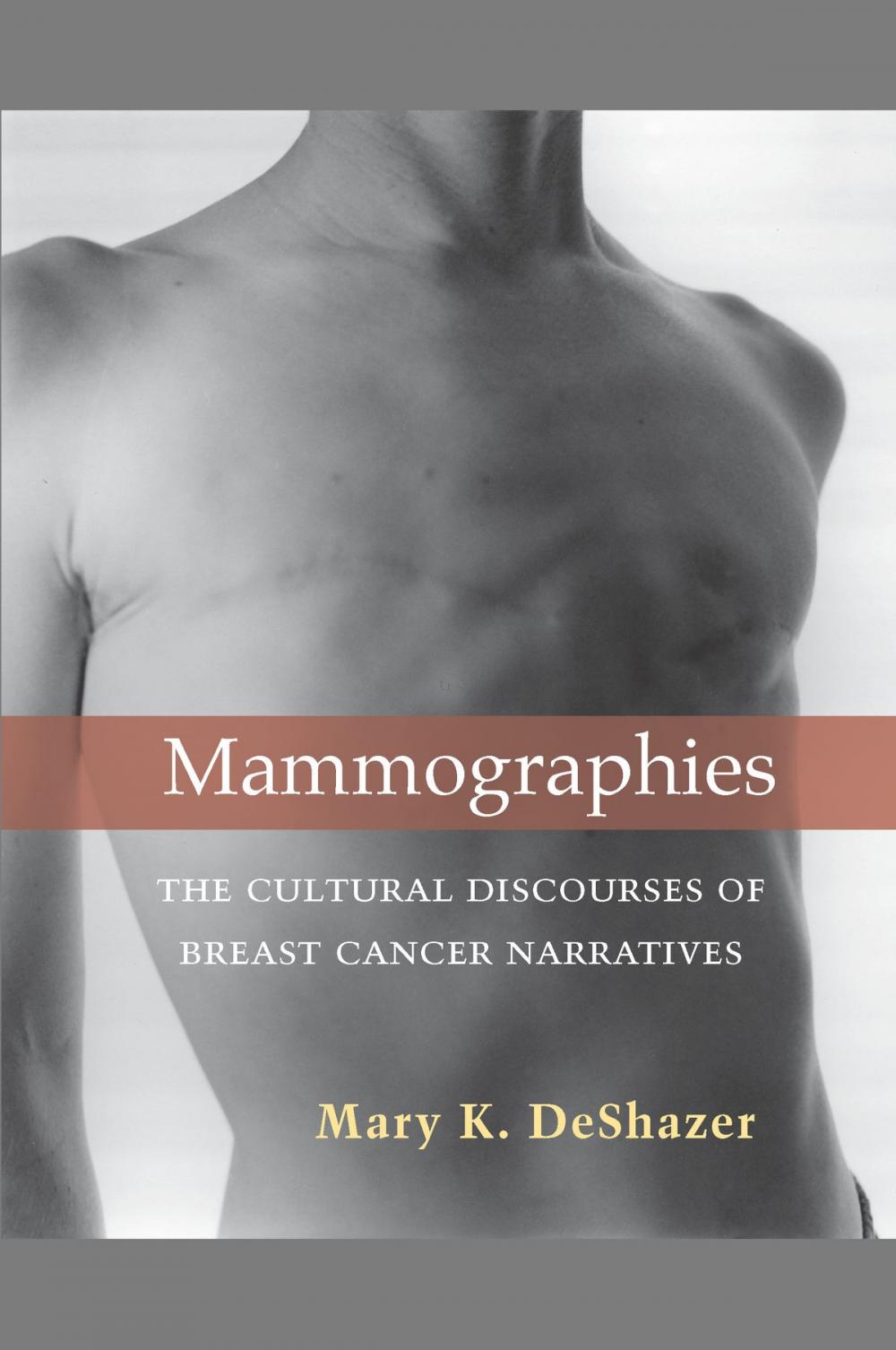 Big bigCover of Mammographies