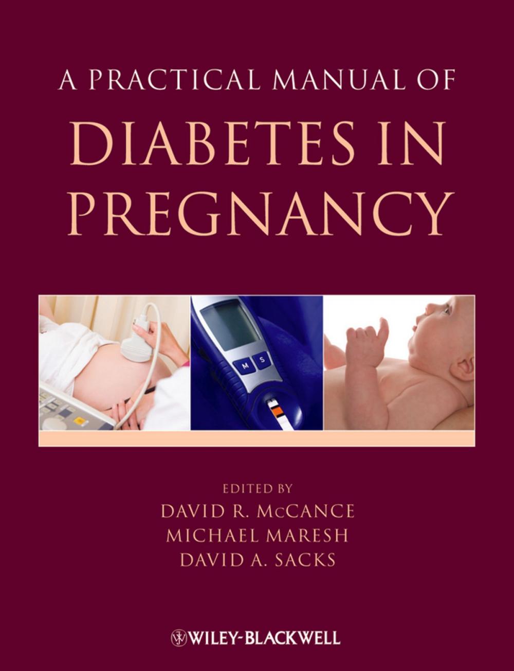 Big bigCover of A Practical Manual of Diabetes in Pregnancy