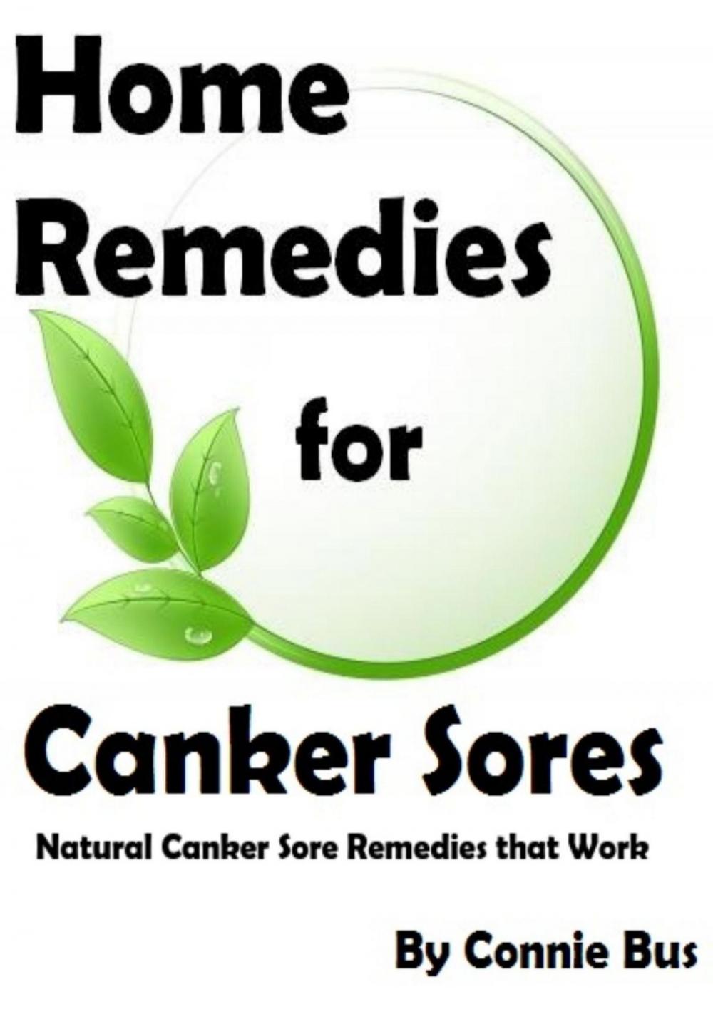 Big bigCover of Home Remedies for Canker Sores: Canker Sore Remedies that Work