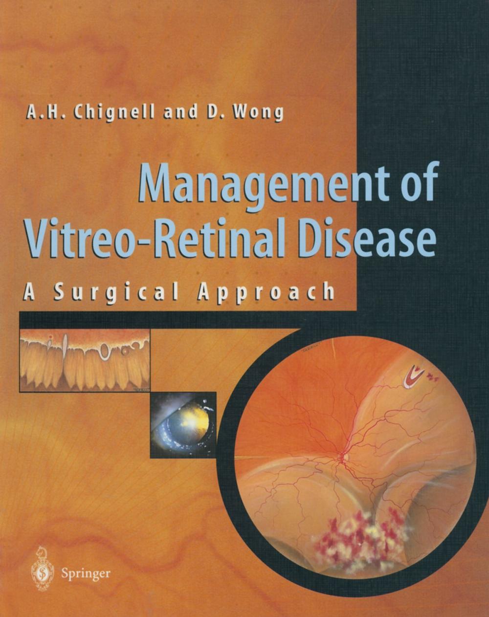 Big bigCover of Management of Vitreo-Retinal Disease