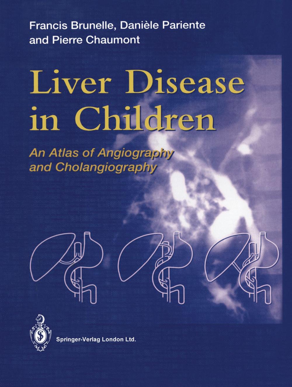 Big bigCover of Liver Disease in Children