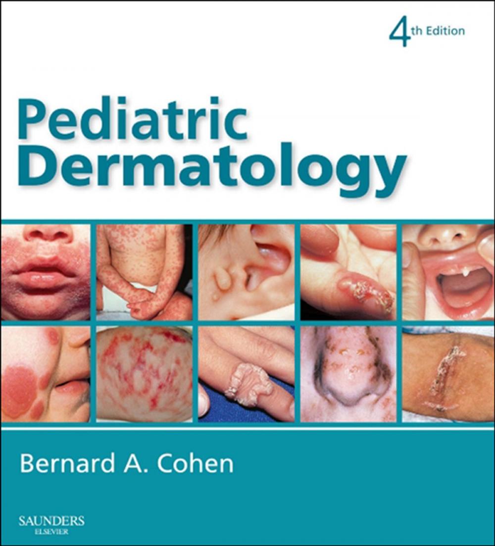 Big bigCover of Pediatric Dermatology E-Book