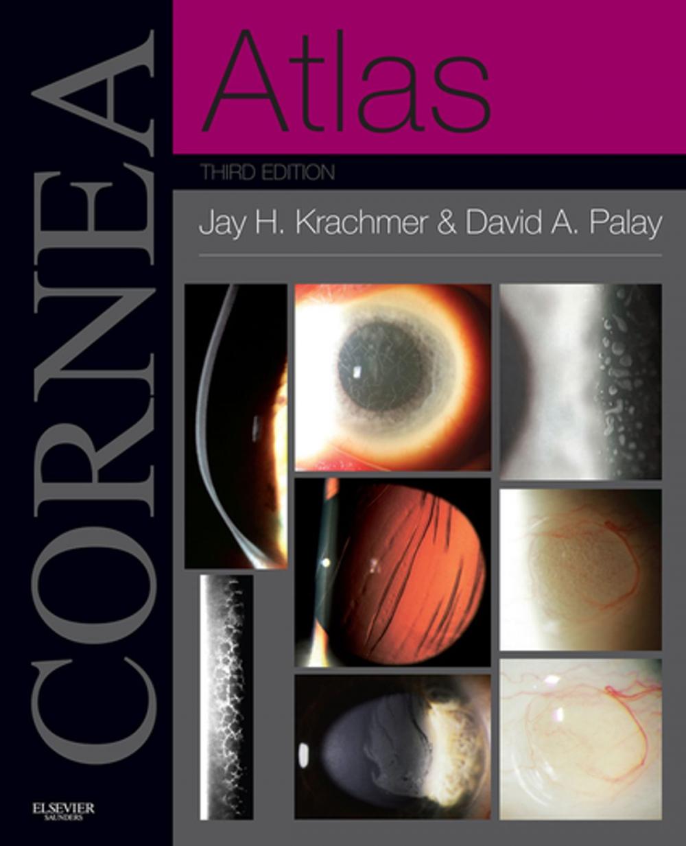 Big bigCover of Cornea Atlas E-Book