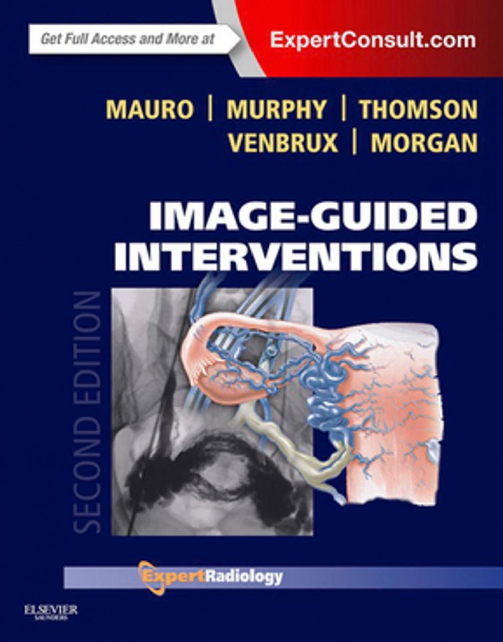 Big bigCover of Image-Guided Interventions E-Book