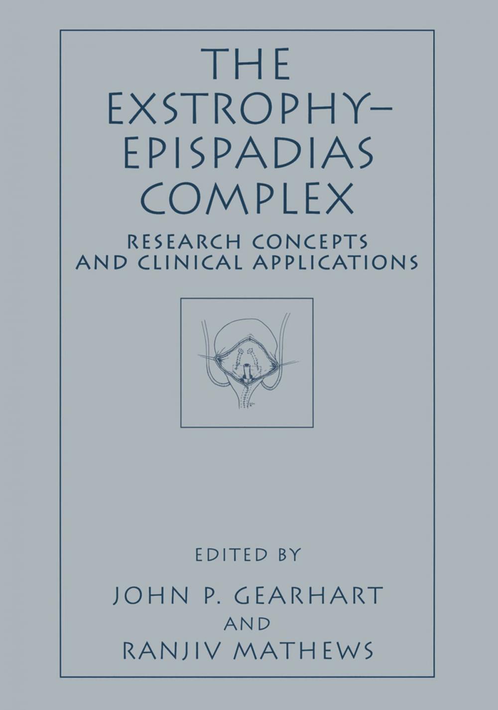 Big bigCover of The Exstrophy—Epispadias Complex