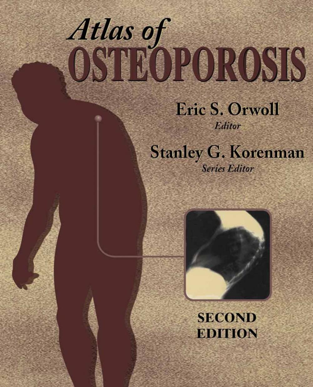 Big bigCover of Atlas of Osteoporosis