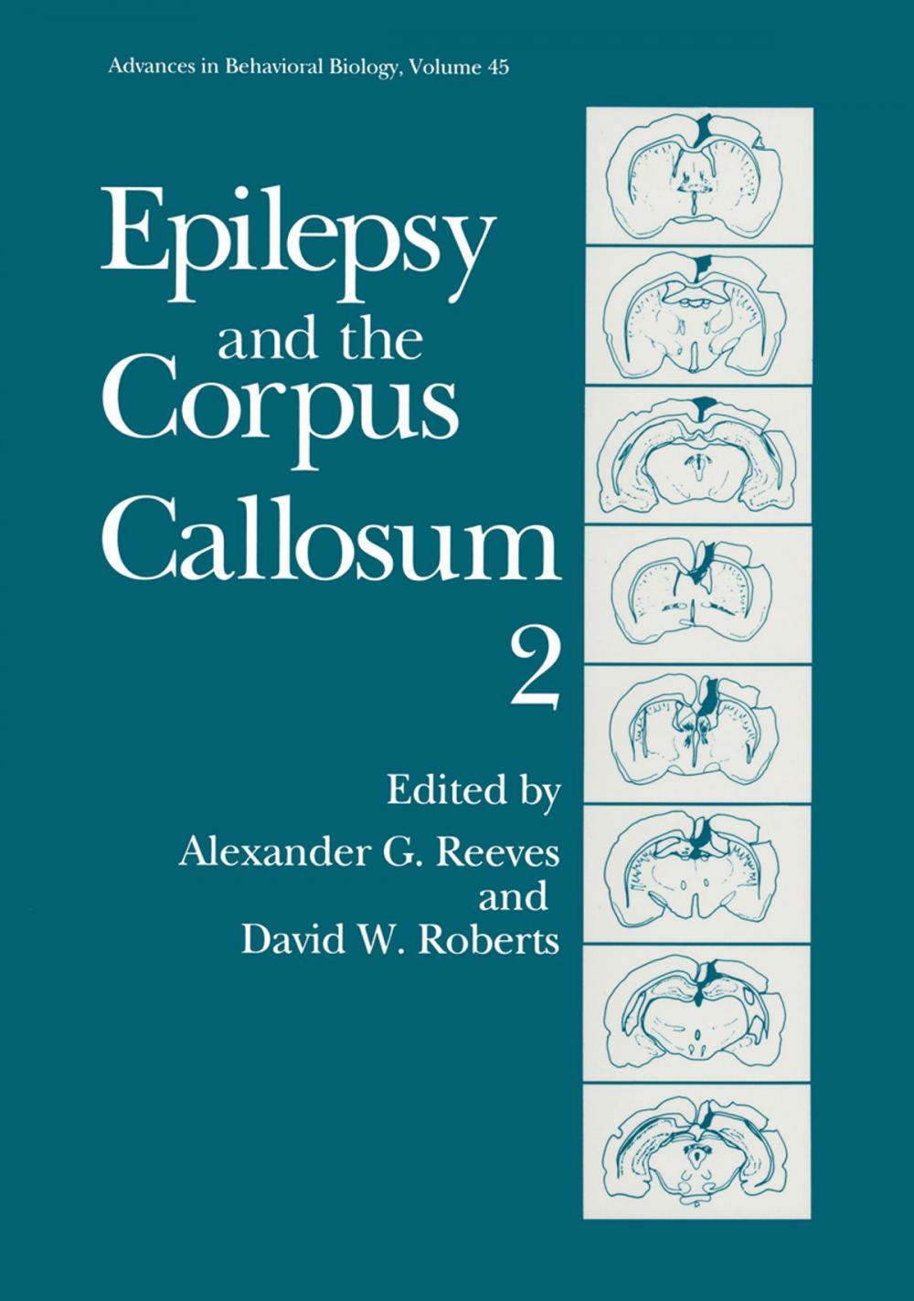 Big bigCover of Epilepsy and the Corpus Callosum 2