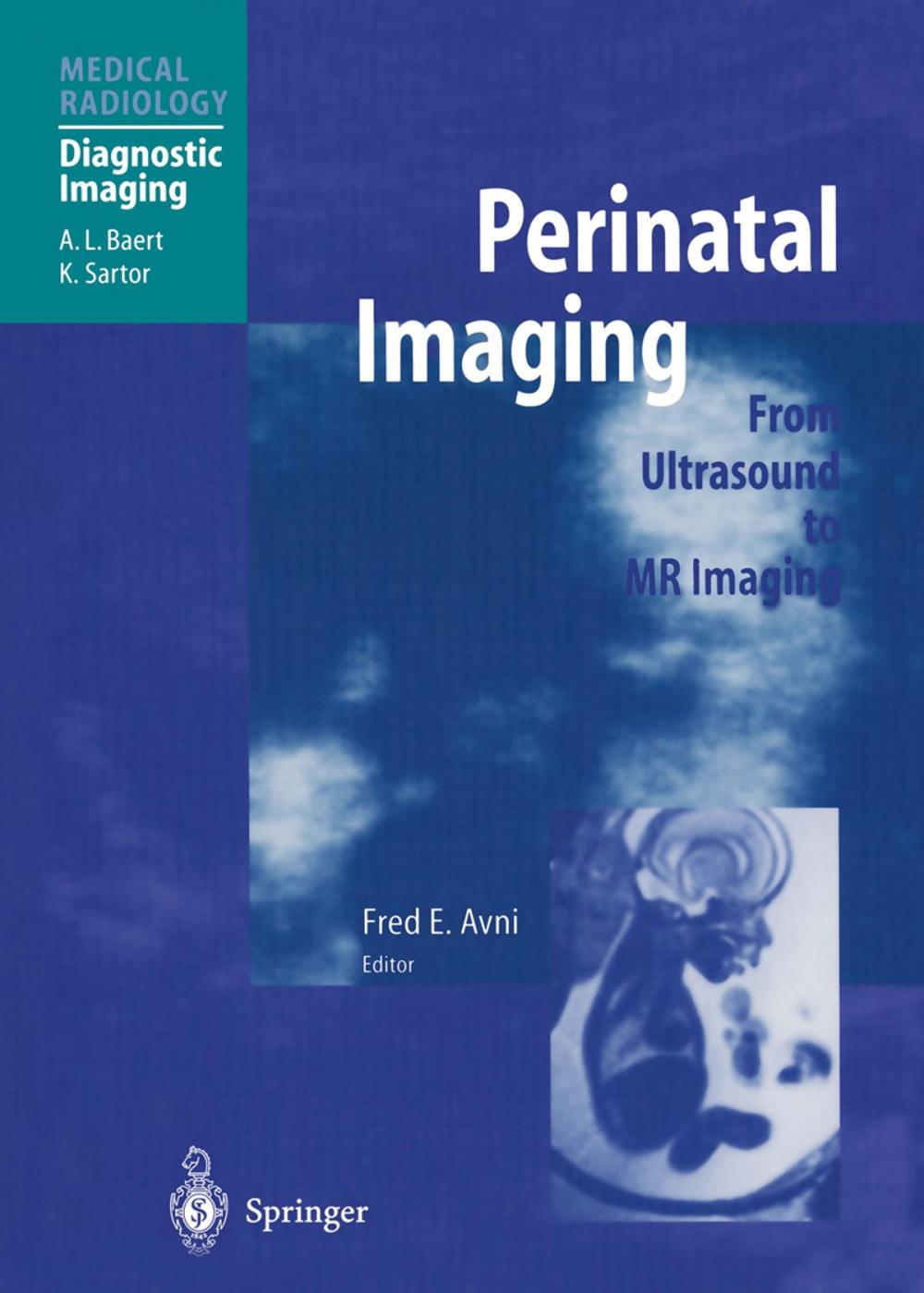 Big bigCover of Perinatal Imaging