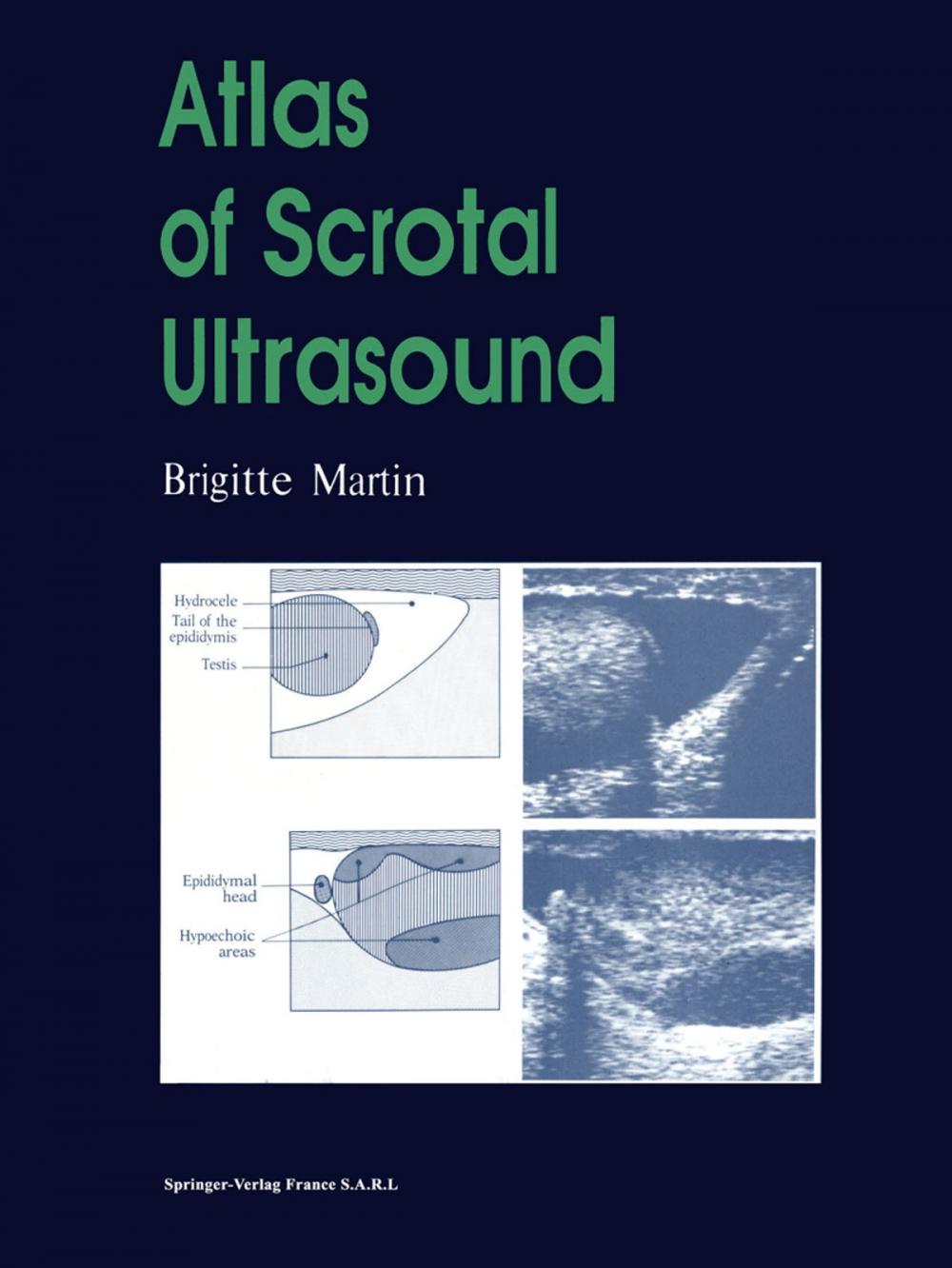 Big bigCover of Atlas of Scrotal Ultrasound