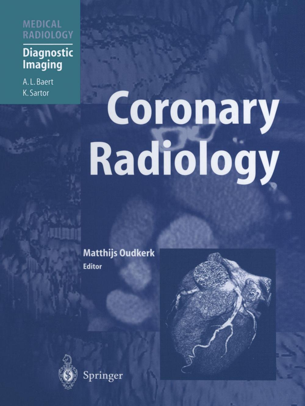 Big bigCover of Coronary Radiology