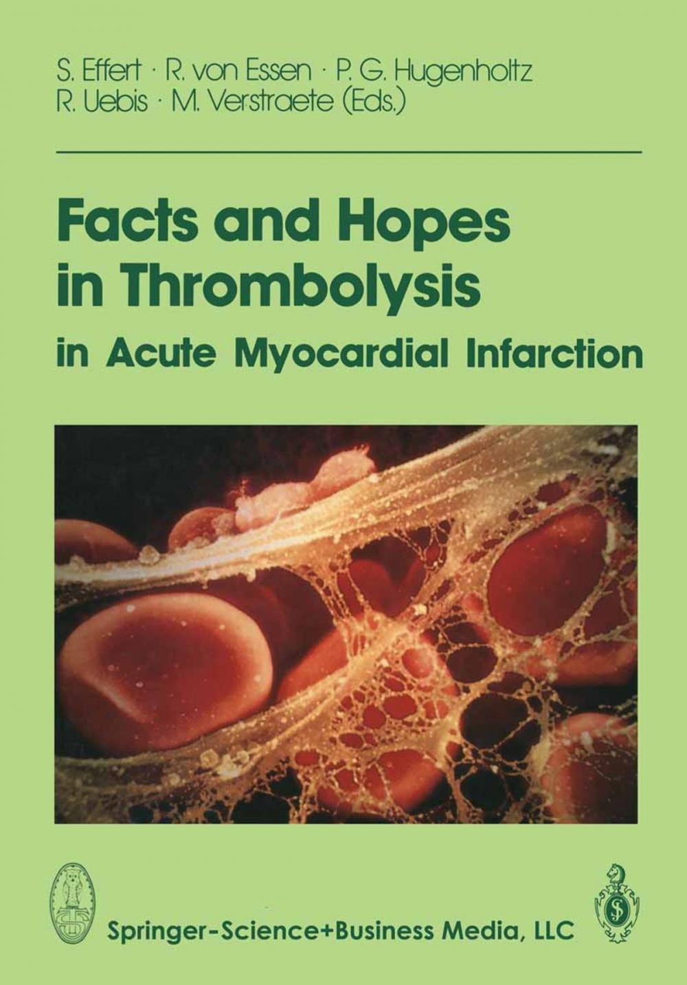 Big bigCover of Facts and Hopes in Thrombolysis in Acute Myocardial Infarction