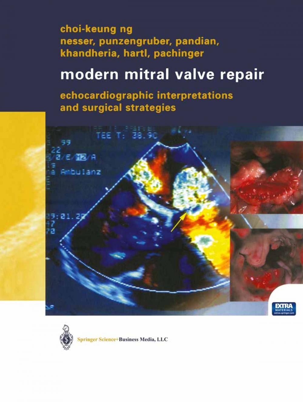 Big bigCover of Modern Mitral Valve Repair