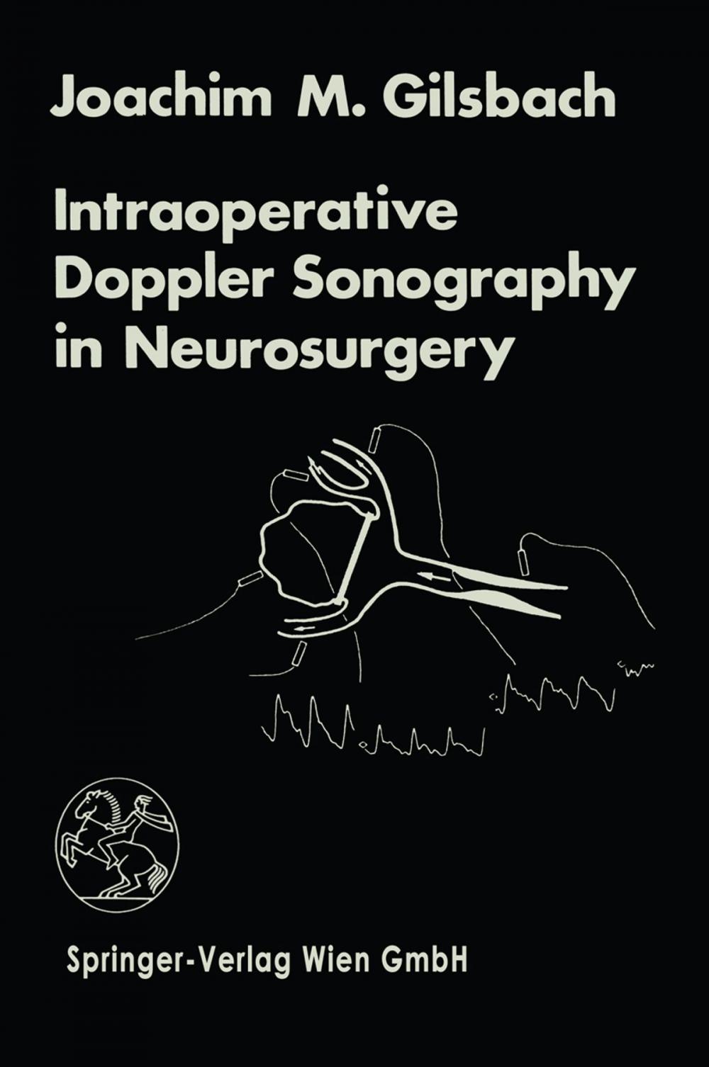 Big bigCover of Intraoperative Doppler Sonography in Neurosurgery