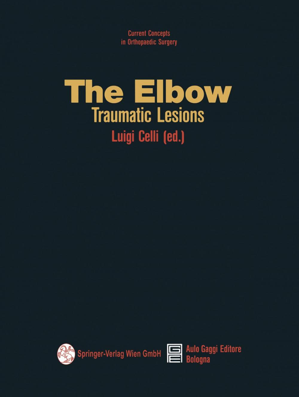 Big bigCover of The Elbow