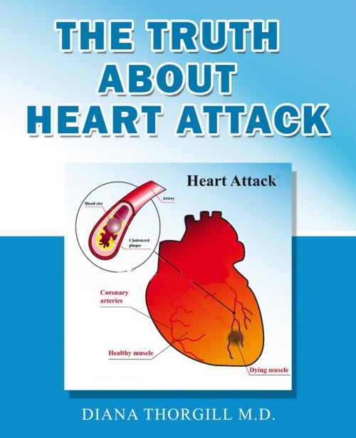 Cover of the book The Truth About Heart Attack: All You Need to Know about Heart Attack and How it is treated by Diana Thorgill, Stories of Everyday's Woe Publishing House