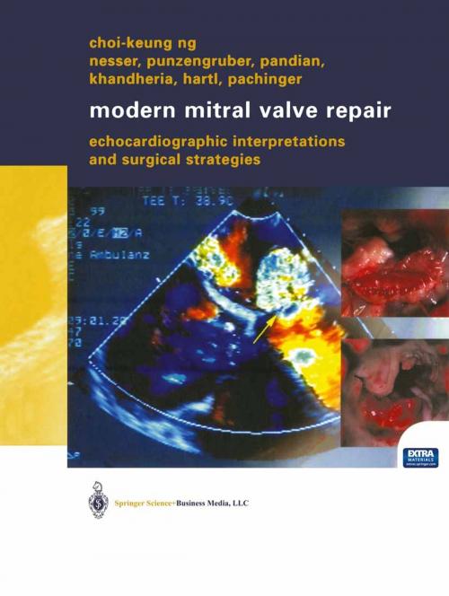 Cover of the book Modern Mitral Valve Repair by Christian Punzengruber, Choi-Keung Ng, Bijoy K. Khandheria, Hans-Joachim Nesser, Natesa G. Pandian, Peter Hartl, Otmar Pachinger, Springer Vienna