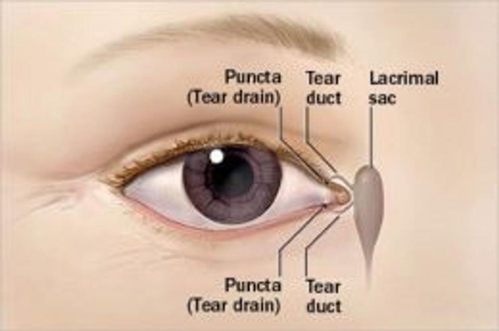 Big bigCover of Blocked Tear Duct: Causes, Symptoms and Treatments