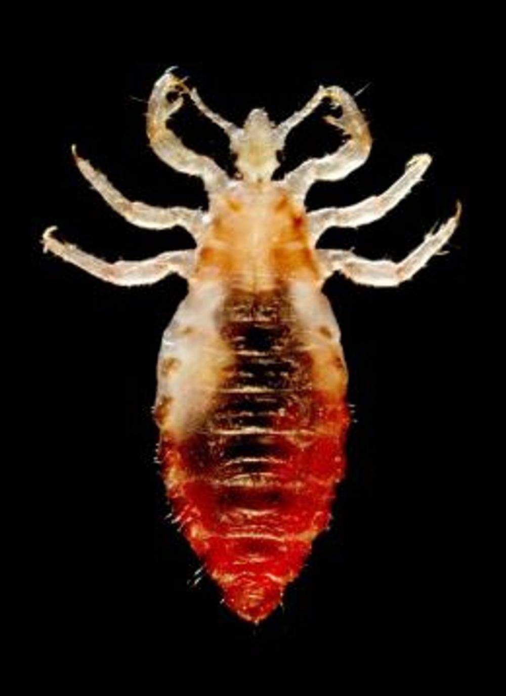 Big bigCover of Body Lice: Causes, Symptoms and Treatments